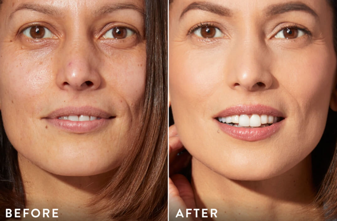 image comparison before